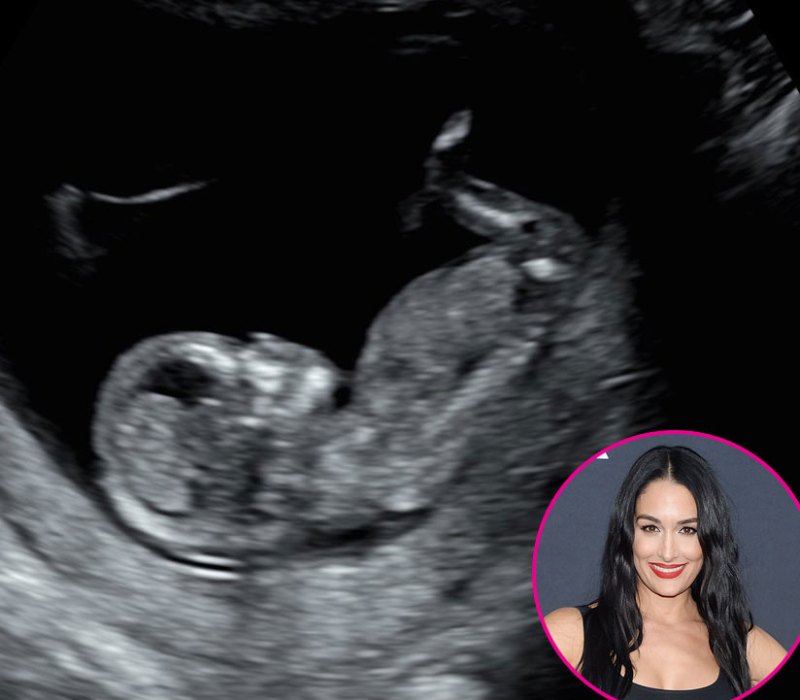 Nikki Bella Pregnant Stars Share Ultrasound Pics