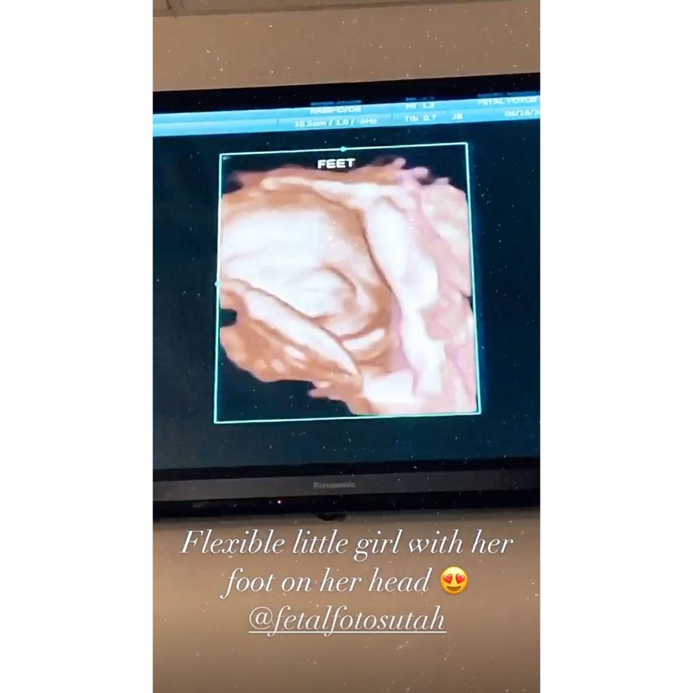 Pregnant Lindsay Arnold Shows Flexible Daughters Ultrasound