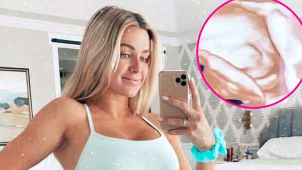 Pregnant Lindsay Arnold Shows Flexible Daughters Ultrasound
