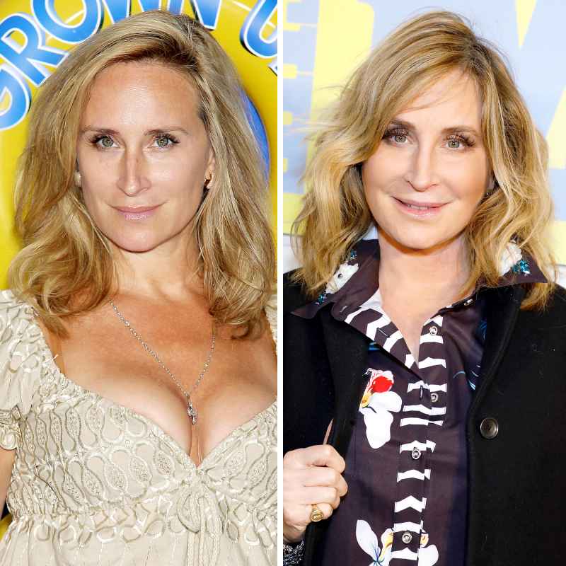 Sonja Morgan before and after plastic surgery