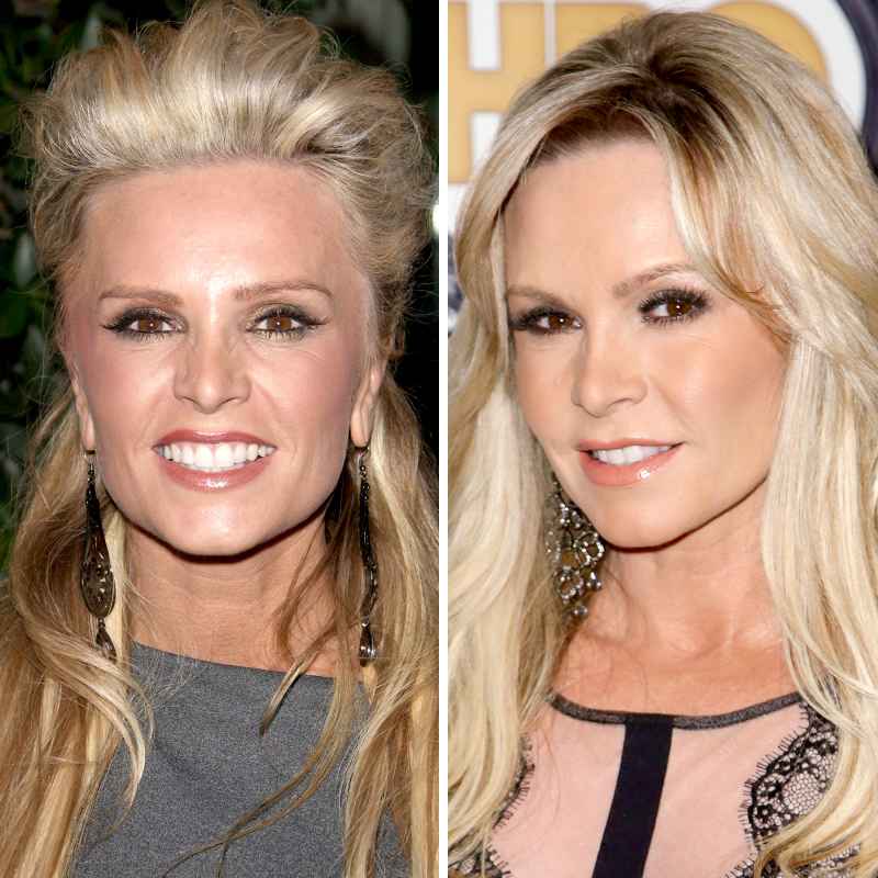 Tamra Barney before and after plastic surgery