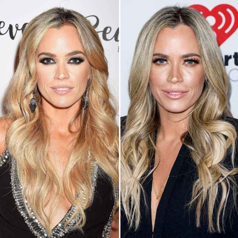 Teddi Mellencamp before and after plastic surgery