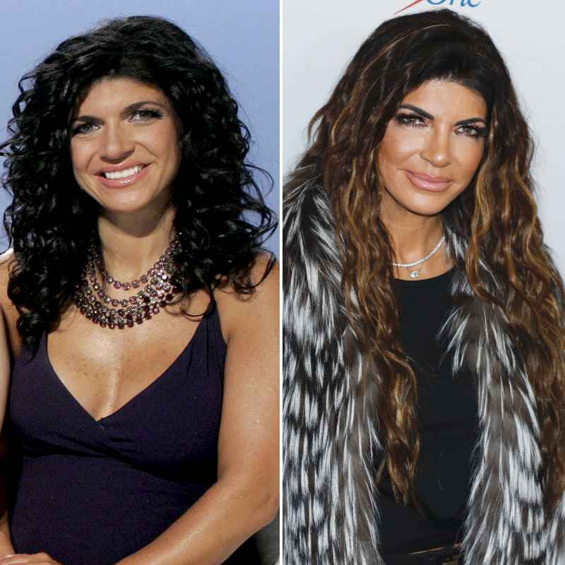 Teresa Giudice before and after plastic surgery