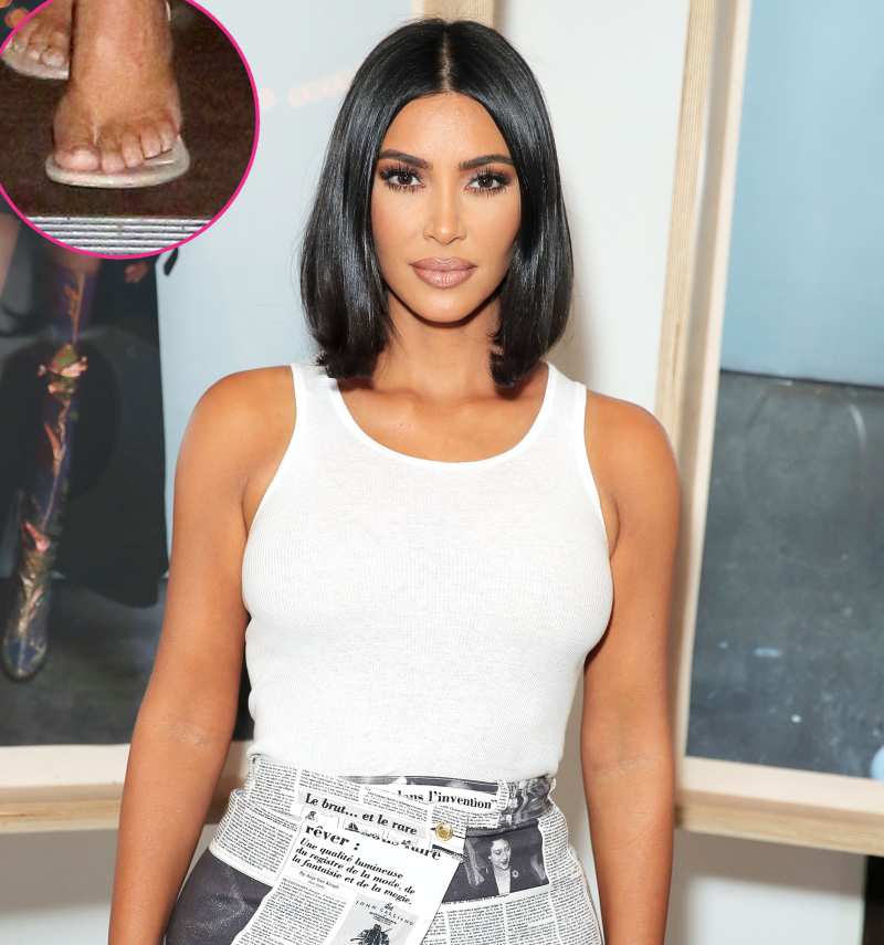 Kim Kardashian 6th Toe Stars With Weird Body Parts
