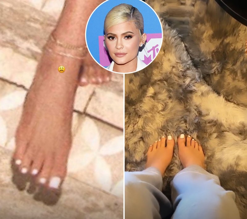Kylie Jenner Shorter Toe Stars With Weird Body Parts