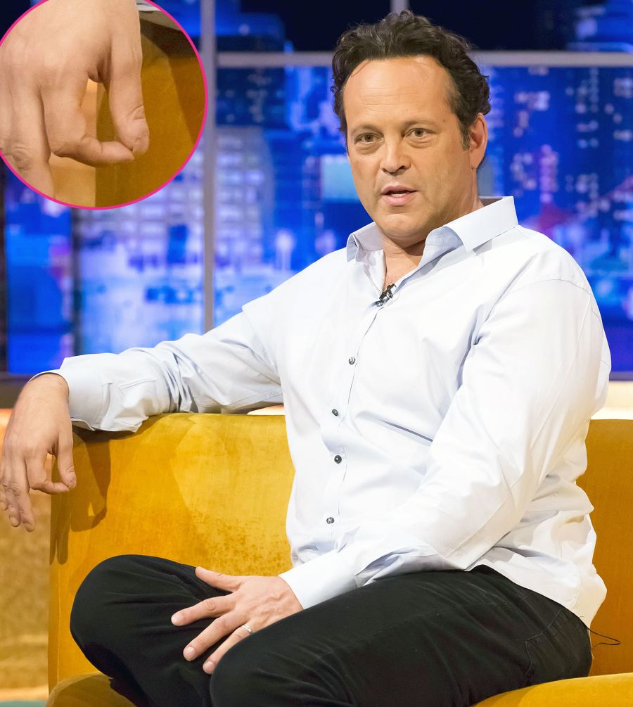 Vince Vaughn Thumb Stars With Weird Body Parts