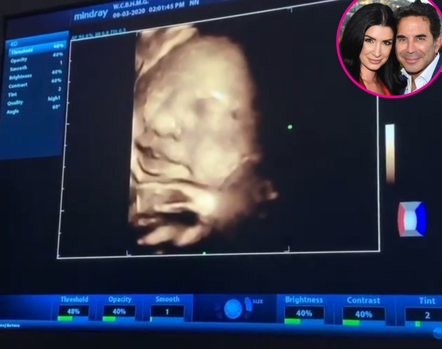 Brittany Nassif More Pregnant Stars Show Ultrasound Pics