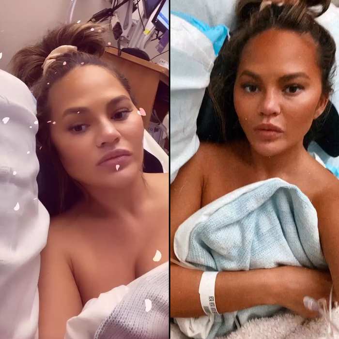 Pregnant Chrissy Teigen Is Hospitalized After Excessive Bleeding