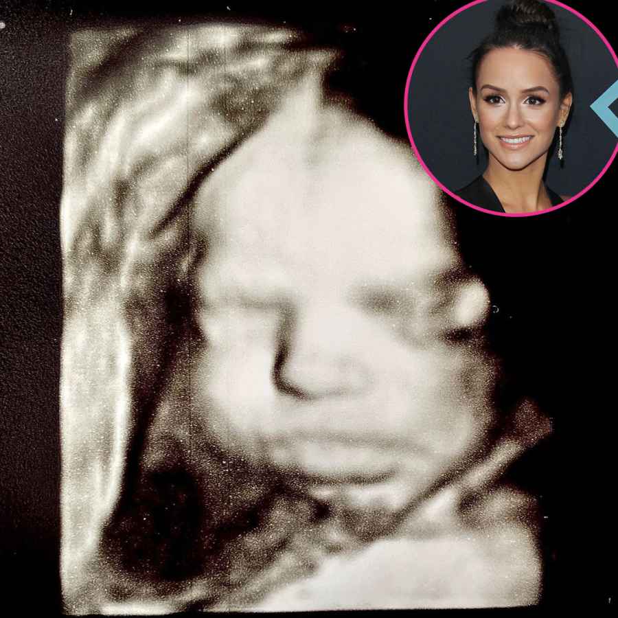 Pregnant Stars Share Ultrasound Pics