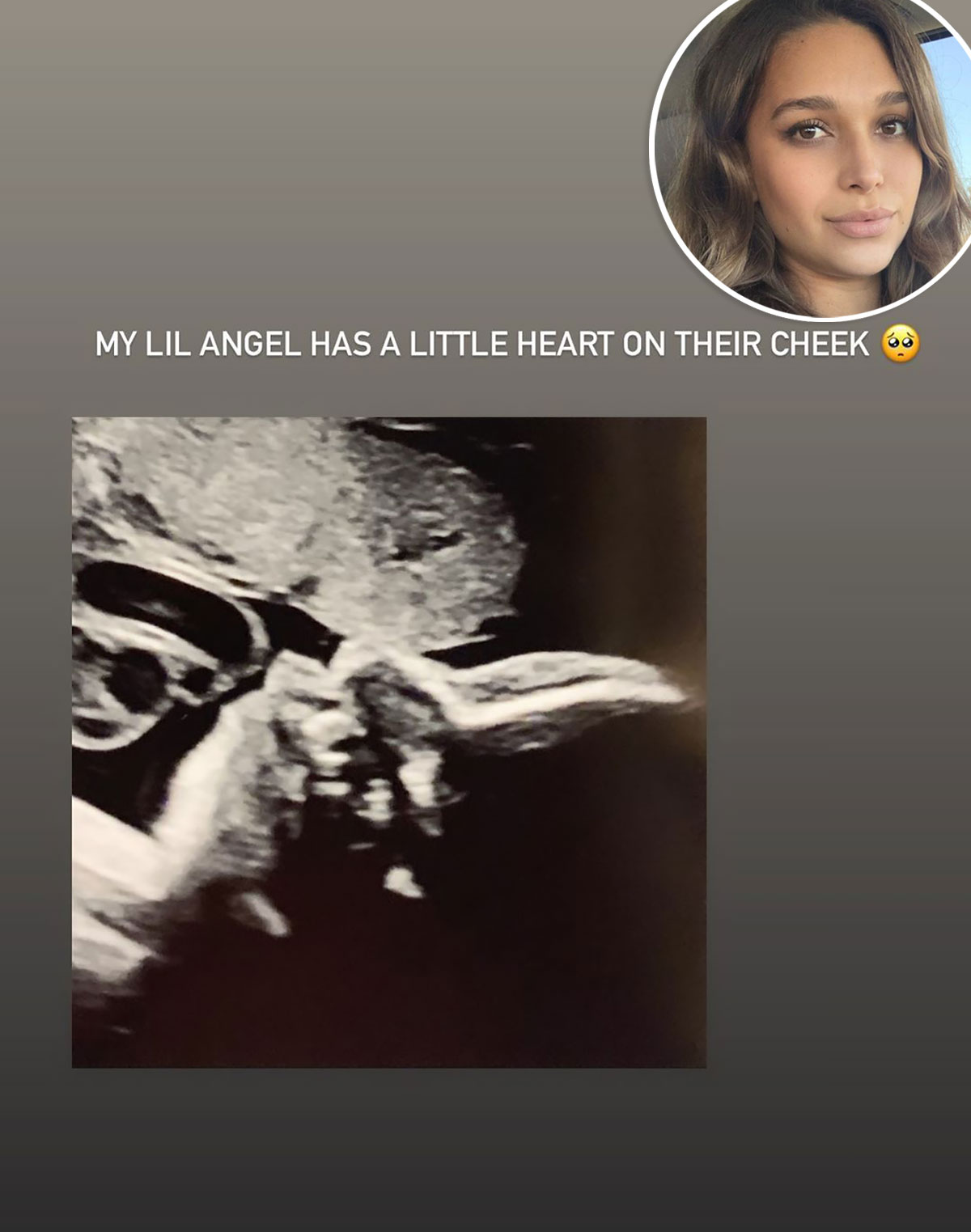 Giving Glimpses! April Love Geary and More Stars Show Ultrasound Pics