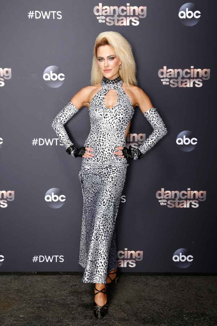 Peta Murgatroyd Had to Run to Therapy for Neck Injury After DWTS