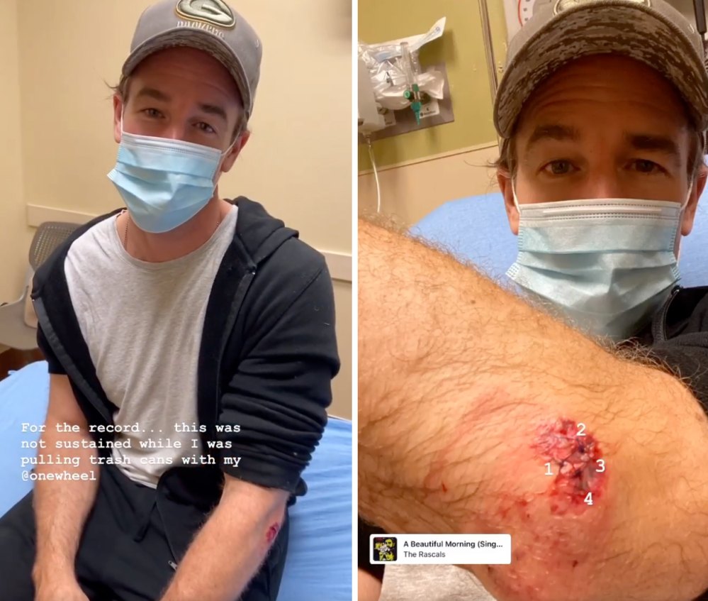 James Van Der Beek Gets 4 Stitches After Skateboarding Accident
