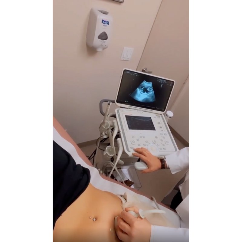 Scheana Shay’s Baby Bump ultrasound
