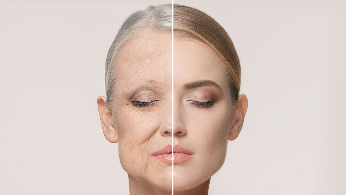 before-after-wrinkle-cream