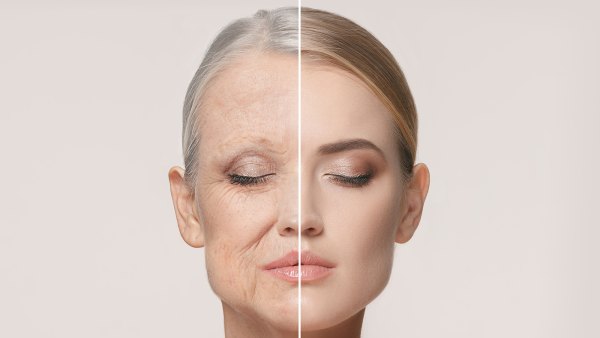 before-after-wrinkle-cream