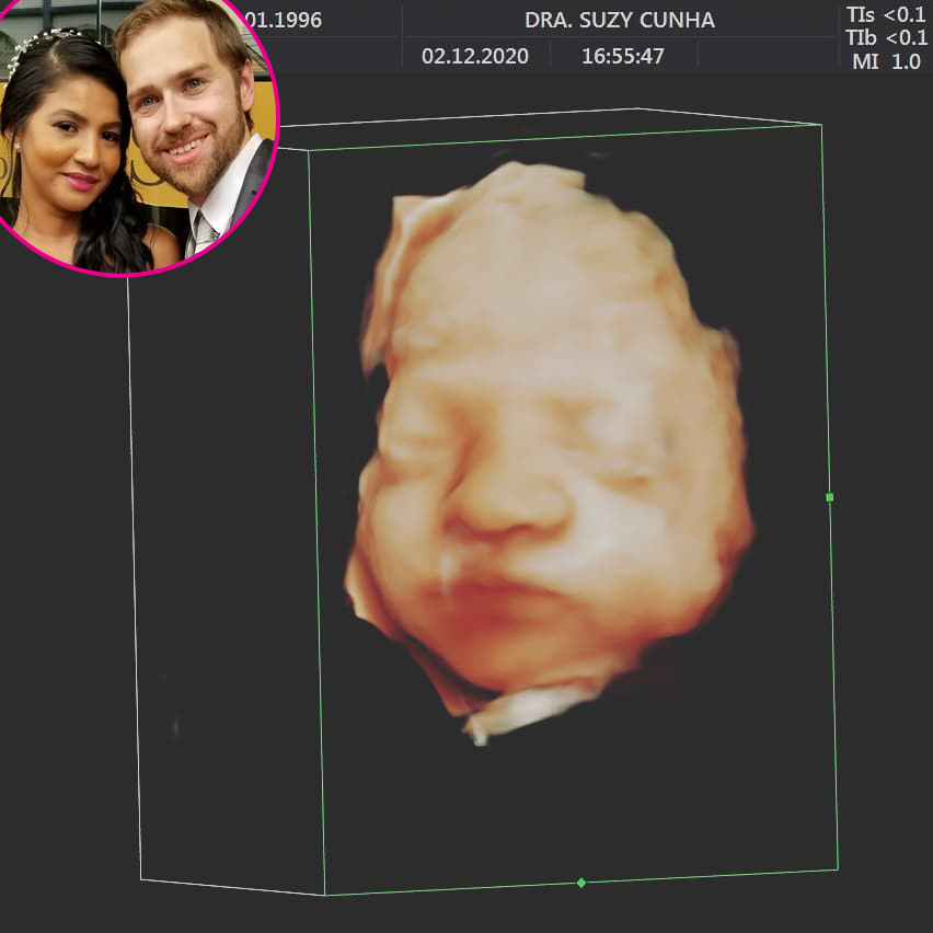 90 Day’s Paul Staehle and More Stars' Ultrasound Pics