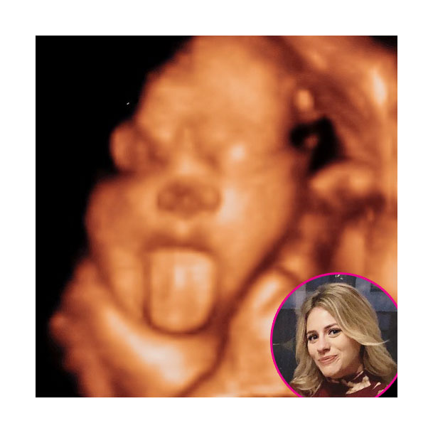 Ashley Petta Shares Sneak Peek of 2nd Baby Ultrasound