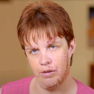 Dr Pimple Popper Sneak Peek Monica Lost Dream Job Due Birthmark