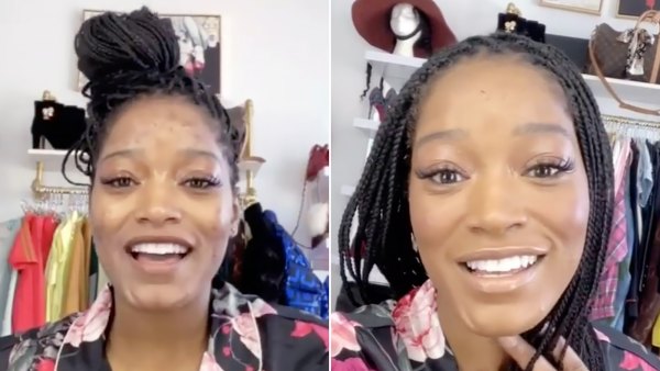 Keke Palmer Shares an 'Extreme Acne Makeup Coverage Tutorial' — Watch