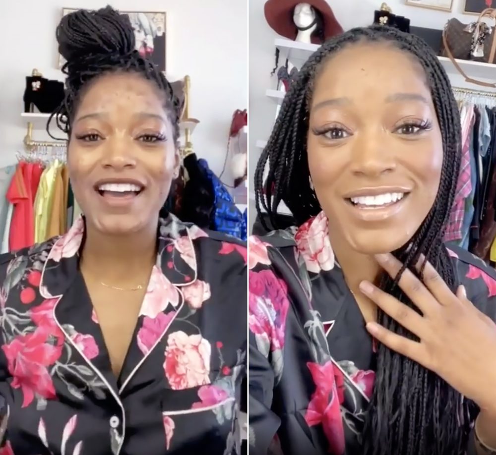 Keke Palmer Shares an 'Extreme Acne Makeup Coverage Tutorial' — Watch
