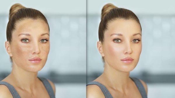 Murad-Before-After