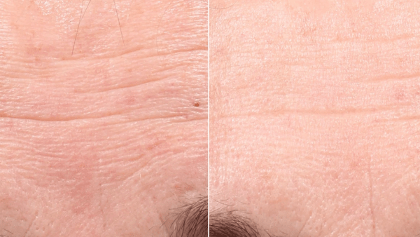 Retinol Youth Renewal Serum