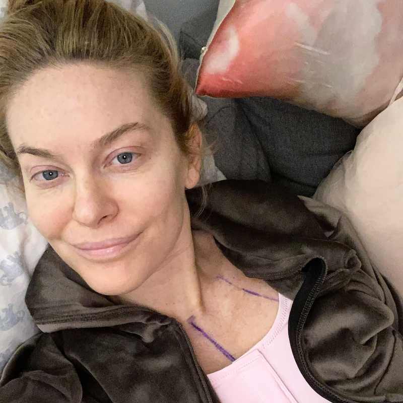 Leah McSweeney Celebs Who Admitted They Got Plastic Surgery