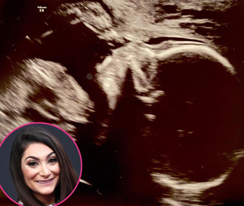 Deena Cortese Pregnant Stars Share Ultrasound Pics