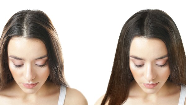 hair-regrowth