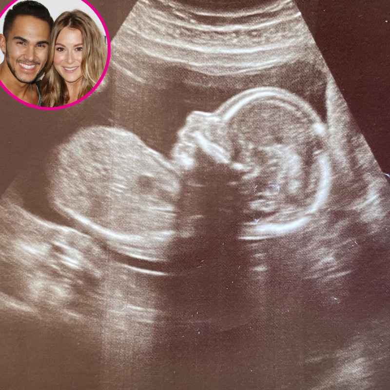 Alexa PenaVega and More Pregnant Stars Share Ultrasound Pics