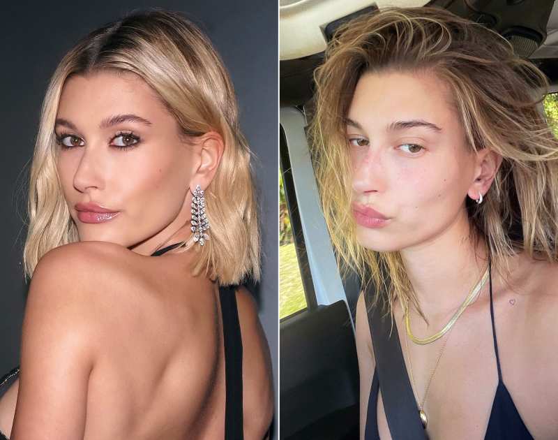 Hailey Baldwin Shows Off Her Freckles Makeup-Free