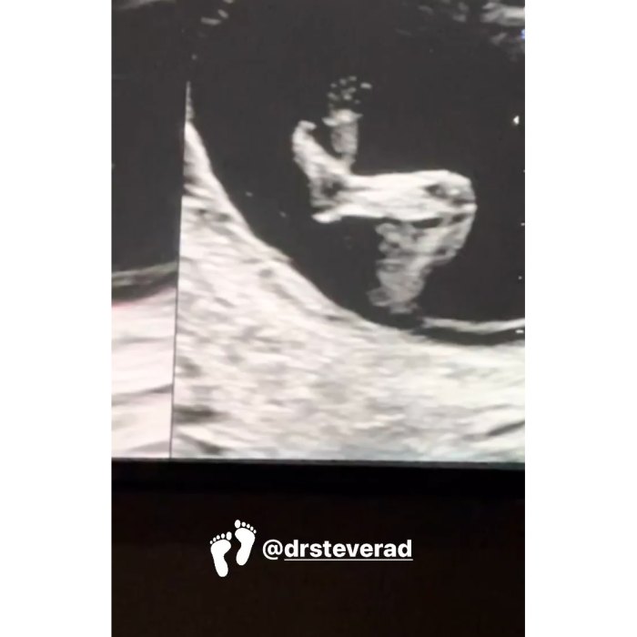 Halsey Shares Adorable Sonogram Pic After Announcing She and Boyfriend Alev Aydin Are Expecting