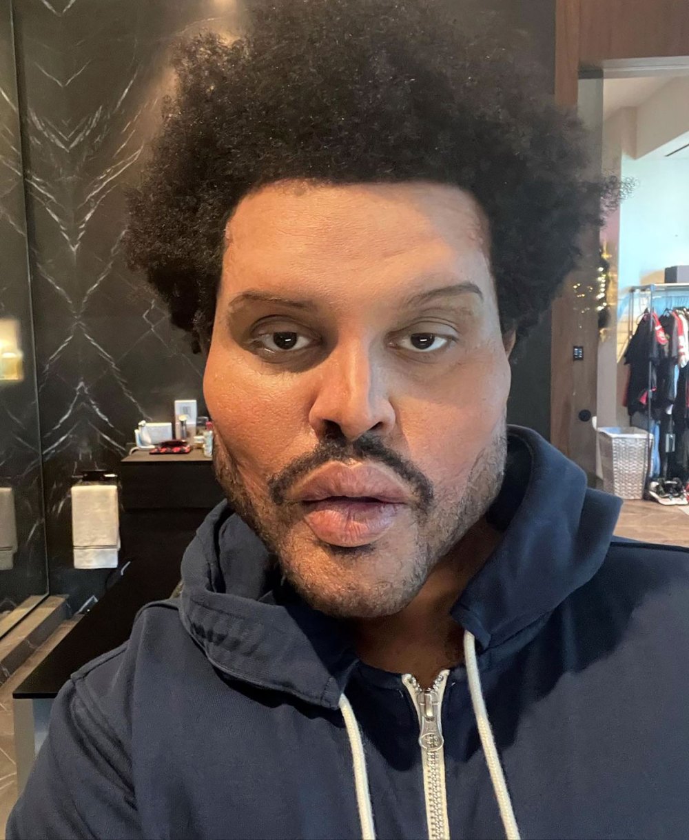 The Weeknd's 'Save Your Tears' Plastic Surgery Look Is Prosthetics