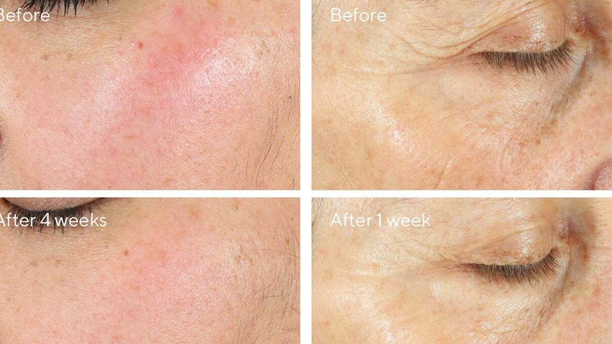 Intense Recovery Cream