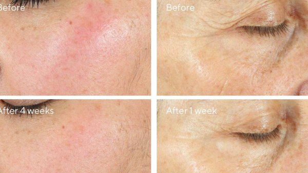 Intense Recovery Cream