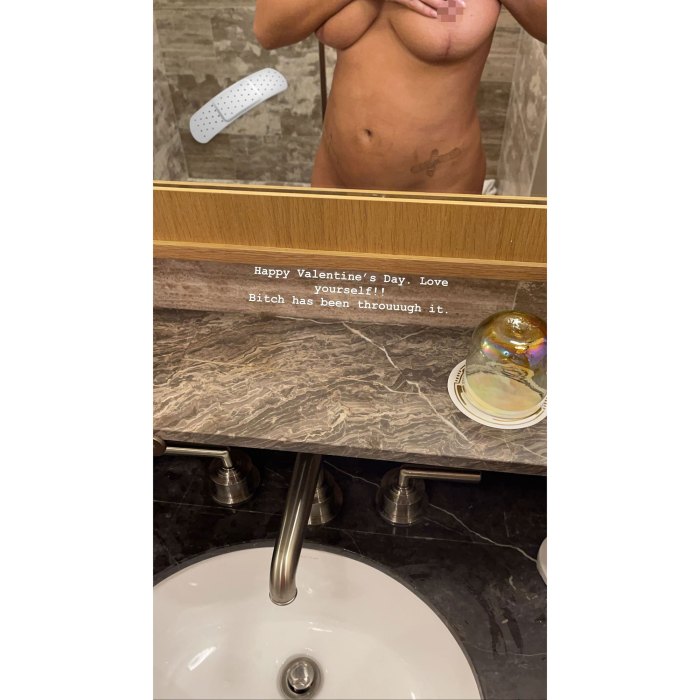 Naked Bitch On The Beach - Chrissy Teigen Posts Nude Selfie 1 Week After Endometriosis Surgery