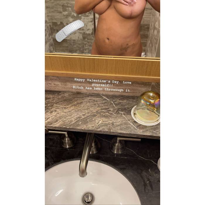 Chrissy Teigen Posts Nude Selfie 1 Week After Endometriosis Surgery