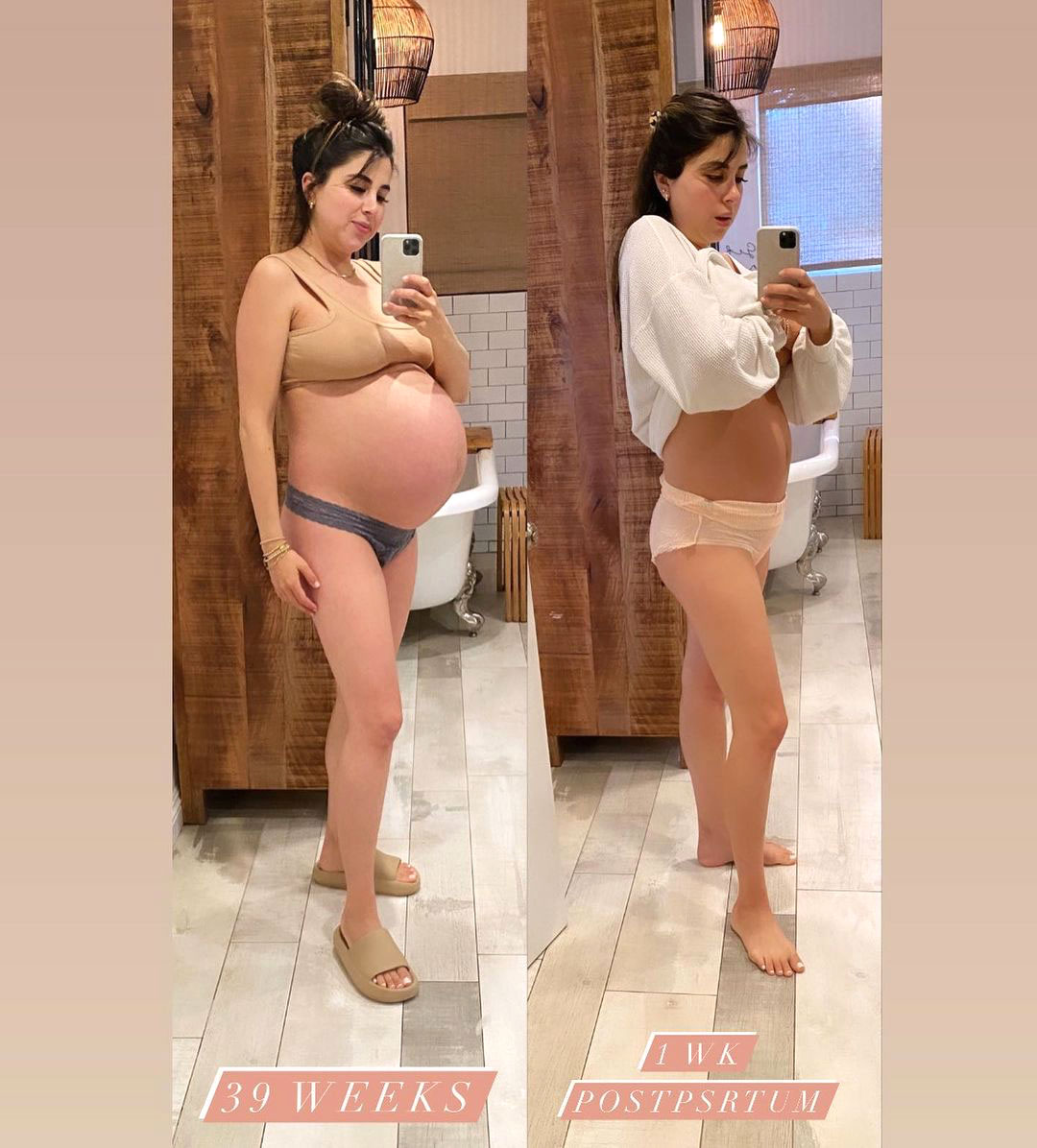 Celeb Moms Debut Postpartum Bodies Days After Giving Birth image photo