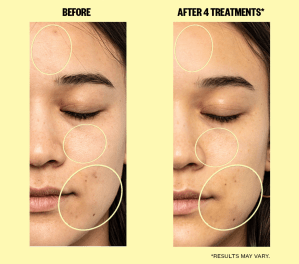 Dullness One-Step Brightening Face Pads