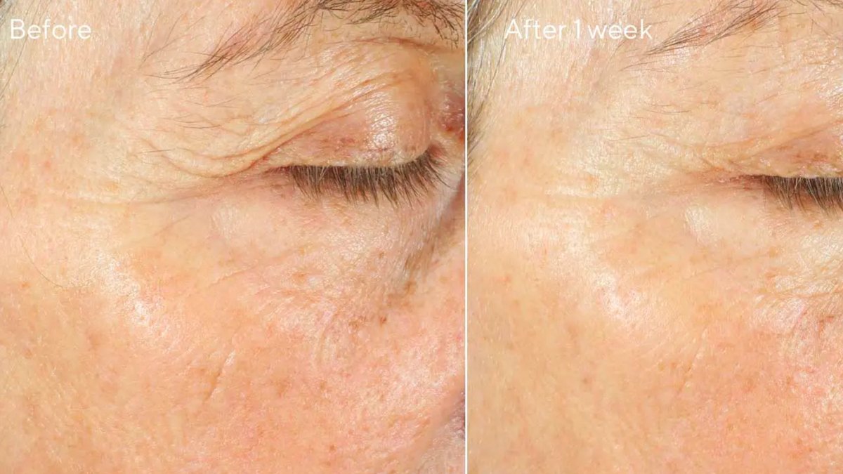 Intense Recovery Cream