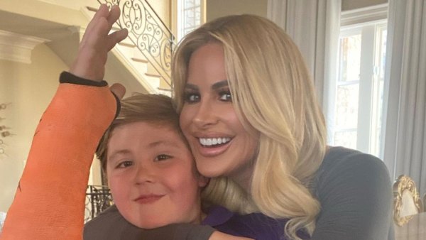 Kim Zolciak’s Son Kash Breaks Arm