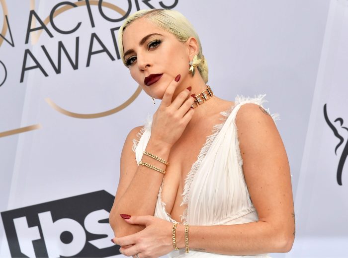 Lady Gaga Dognapper Eyewitness Believes Incident Was ‘Planned Out’