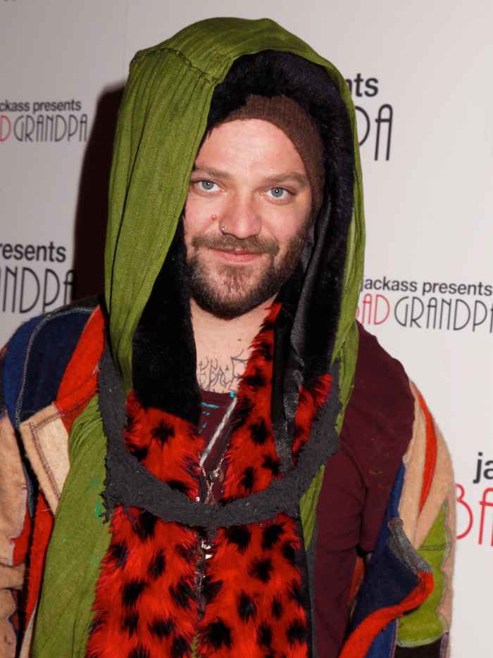 Bam Margera Hospitalized With Staph Infection From Tattoo: Pics