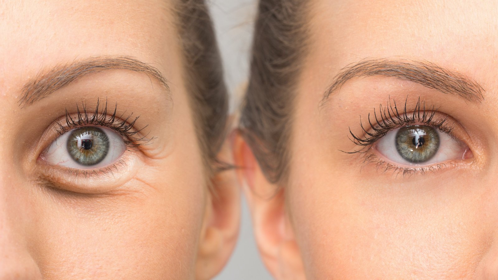 Before-After-Eye-Cream-Stock-Photo
