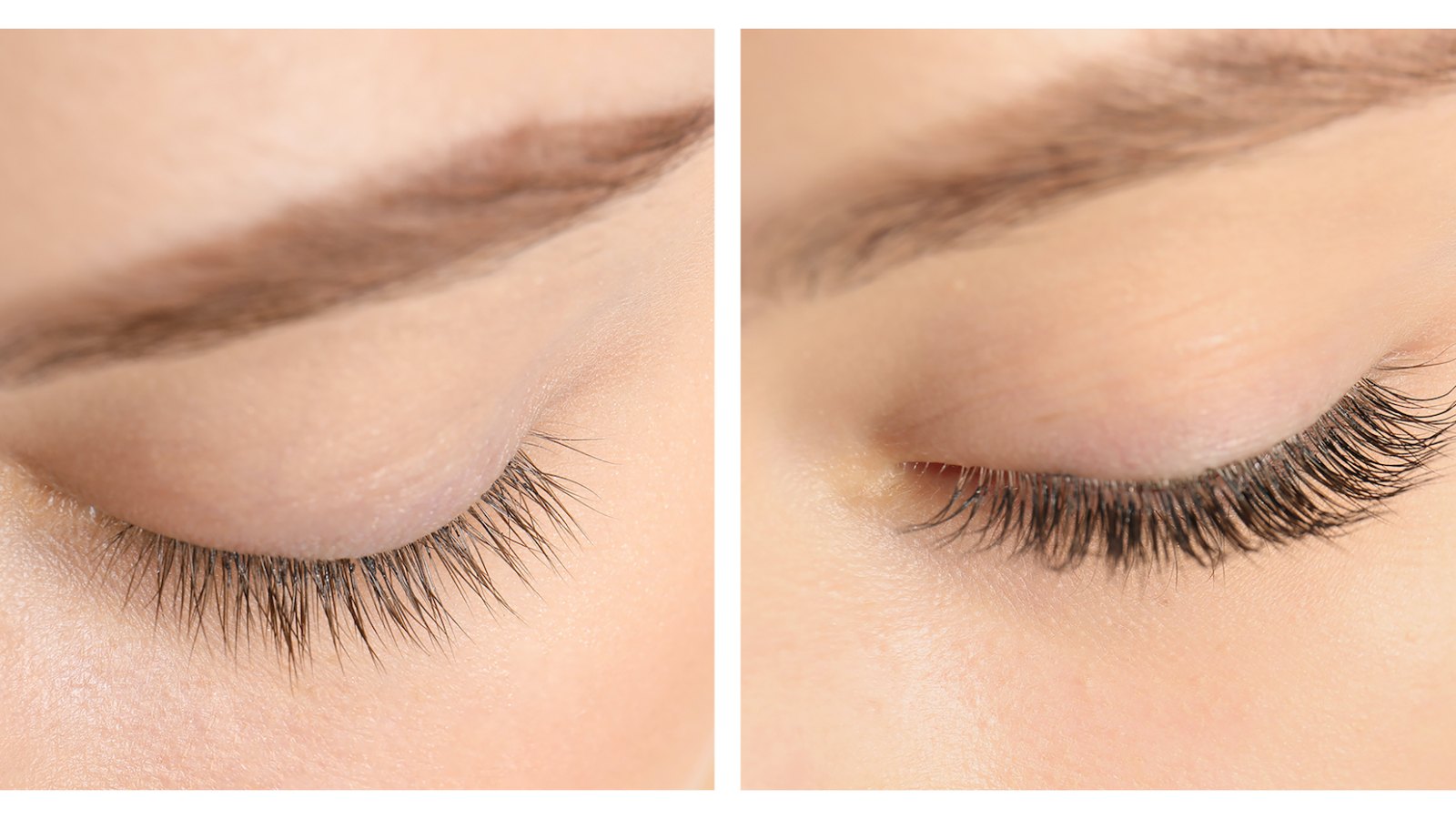 Before-After-Eyelash-Growth-Stock-Photo