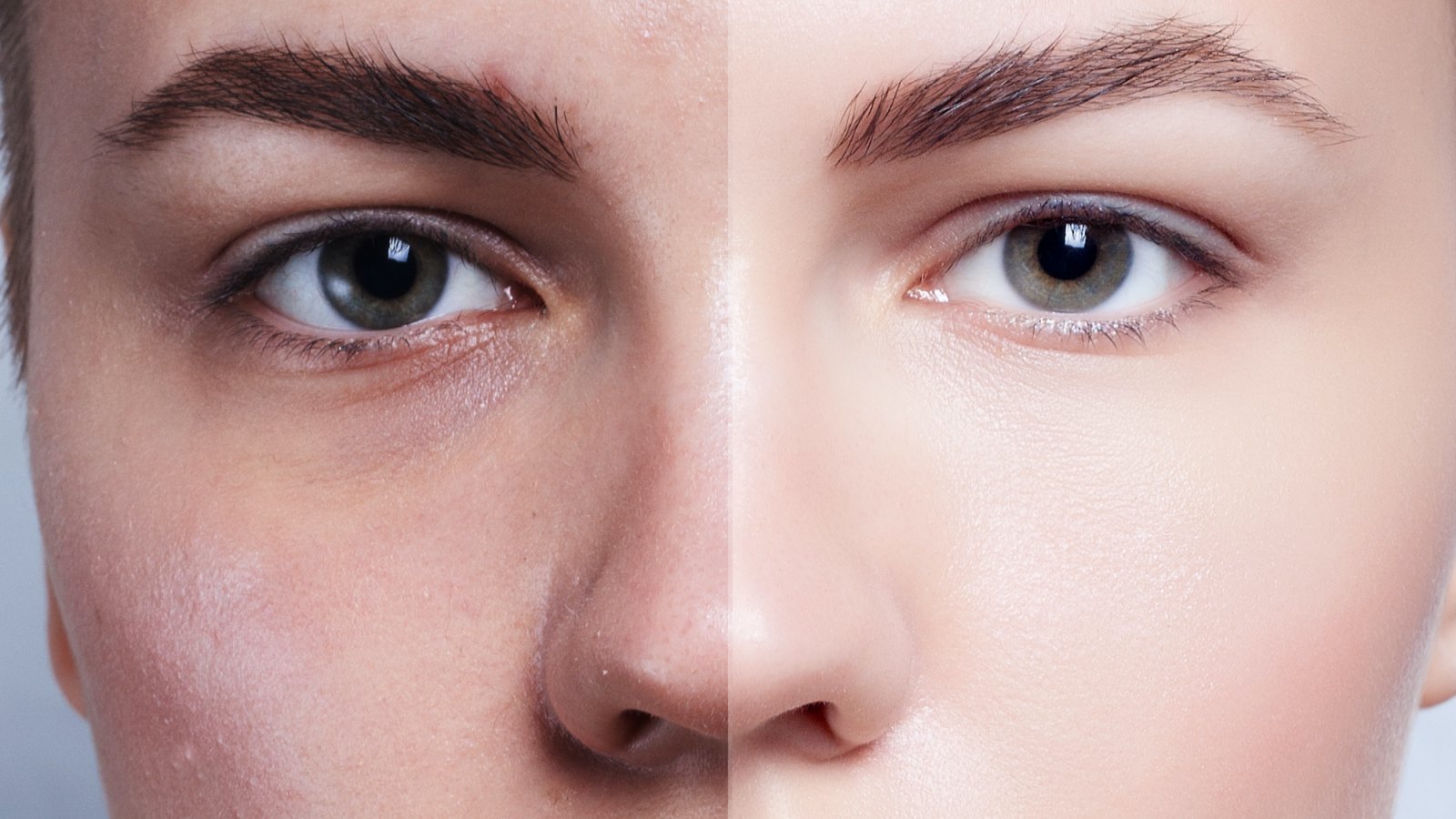 Before-After-Glowing-Skin-Stock-Photo