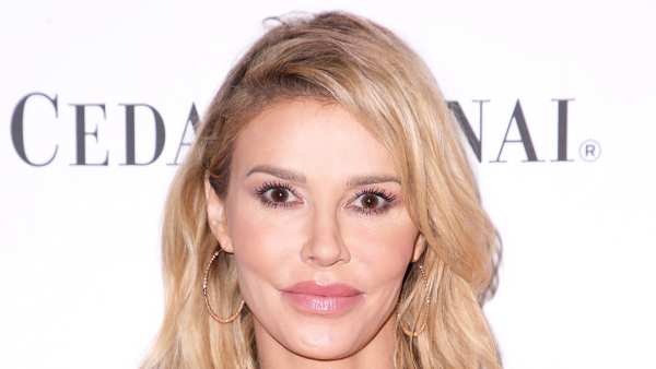 Brandi Glanville Got ‘Painful’ Burns After At-Home Psoriasis Treatment: Pic