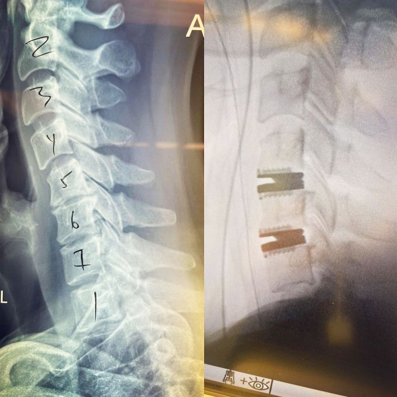 Katherine Heigl Updates Fans After Neck Surgery