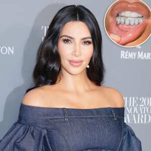 Kim Kardashian's Diamond and Opal Grill Is Estimated at $TK