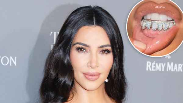 Kim Kardashian's Diamond and Opal Grill Is Estimated at $TK